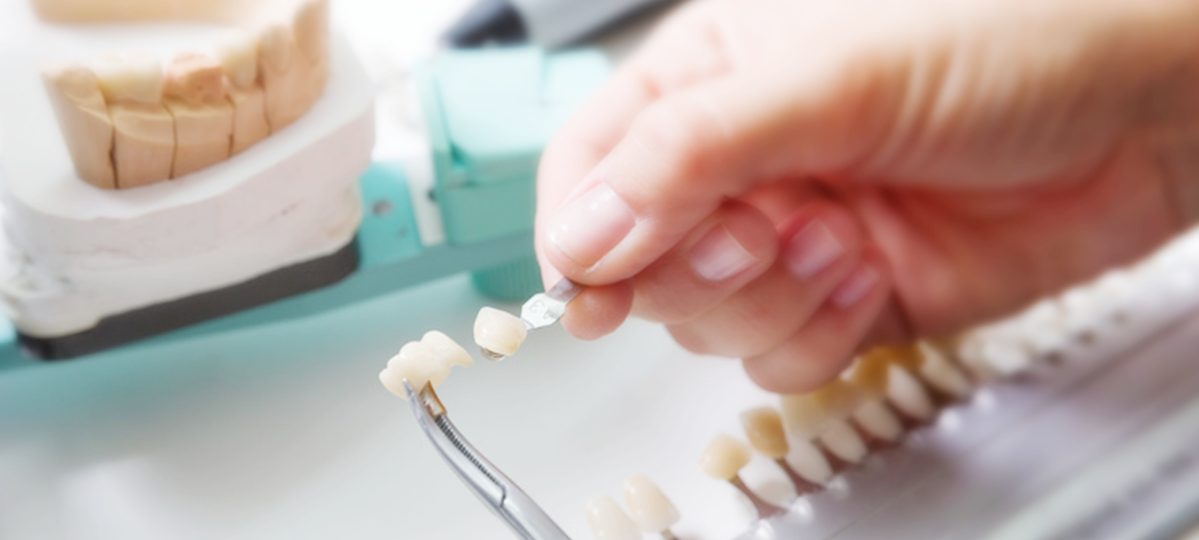 補綴治療に使用する歯科素材