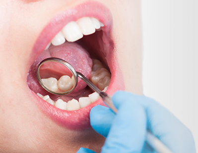 健康な歯を保全する「メンテナンス」