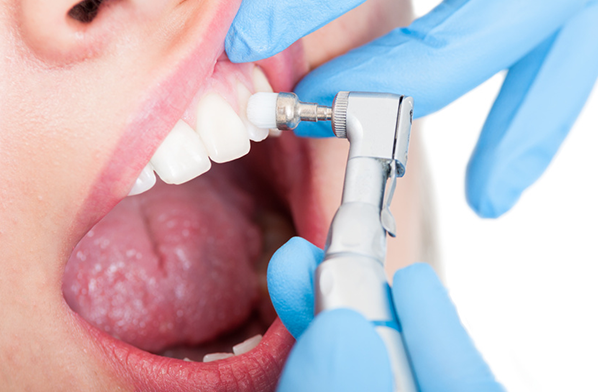 口の中の細菌をコントロールしトラブルを予防する
